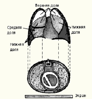 Схема прямой рентгенографической проекции легких